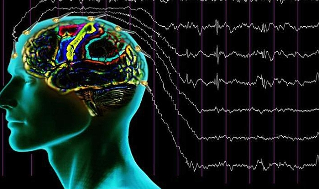 Rüya Aleminde Tarihi Deney: REMspace İki Kişinin Rüyada İletişim Kurduğunu Açıkladı